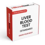 Liver Blood Test Guide for Residents of Ipswich